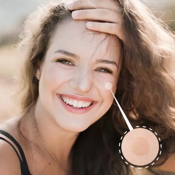 Magic Skin Patch to Remove Skin Tags, Pimples, Blackheads