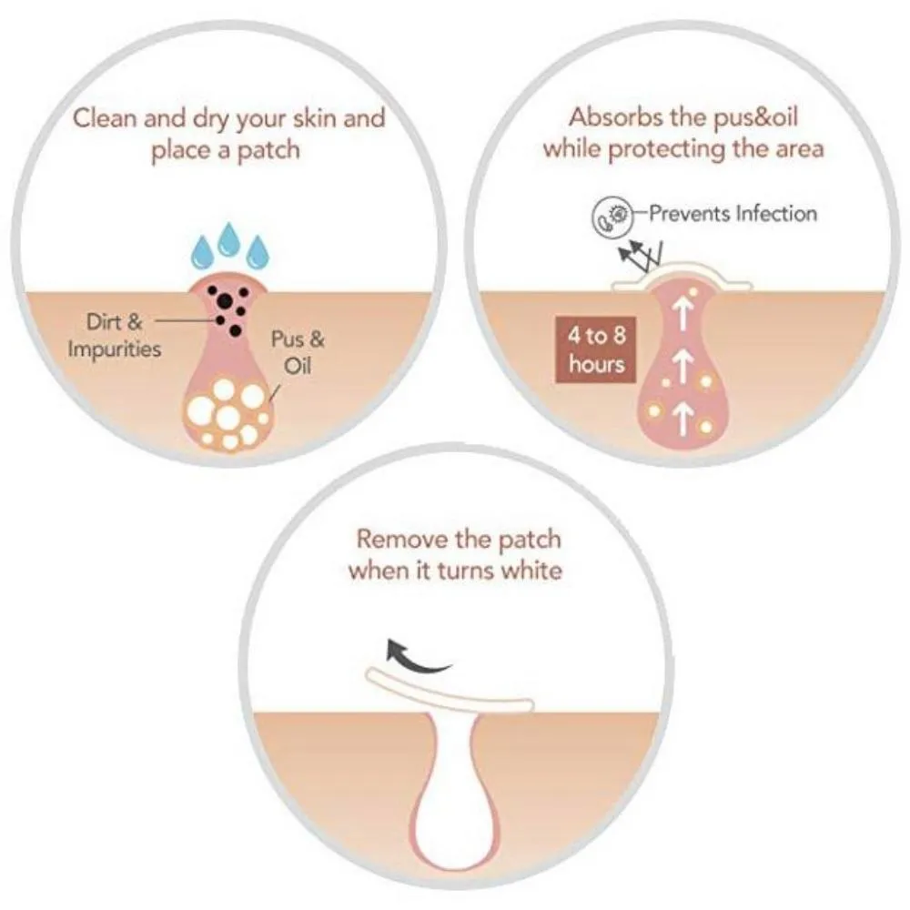 Magic Skin Patch to Remove Skin Tags, Pimples, Blackheads