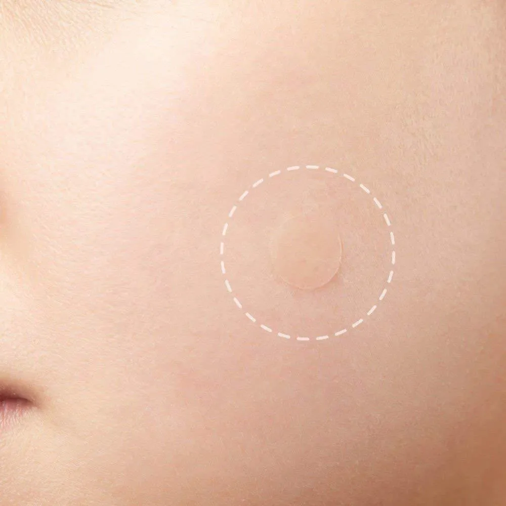 Magic Skin Patch to Remove Skin Tags, Pimples, Blackheads